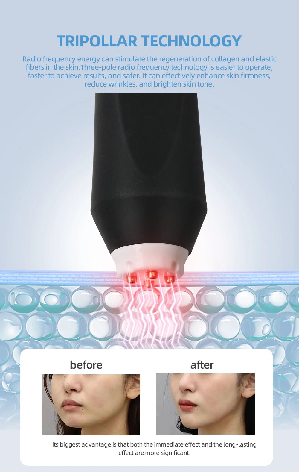 3-in-1 Oxygen Facial Machine for Skin Tightening & Care - Wize-Z