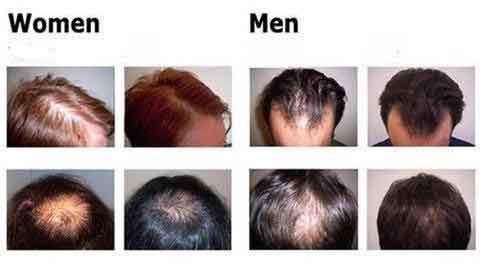 Organic Hair Growth Essence - Wize - Z